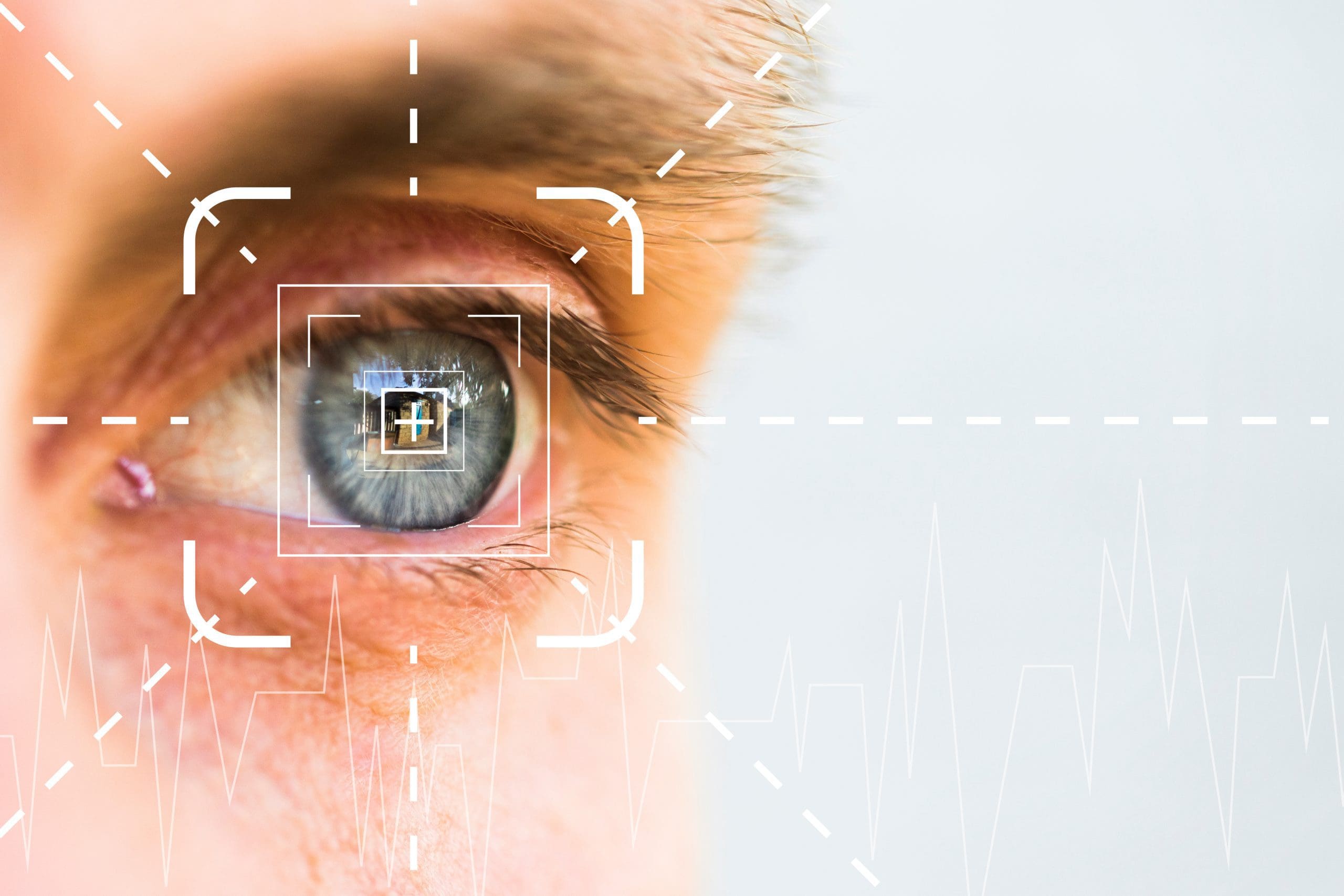Eye monitoring and treatment